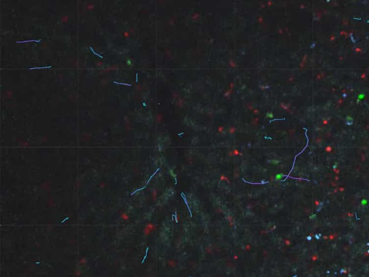 Long Term Intravital Multiphoton Microscopy Imaging of Immune Cells in Healthy and Diseased Liver Using CXCR6.Gfp Reporter Mice
