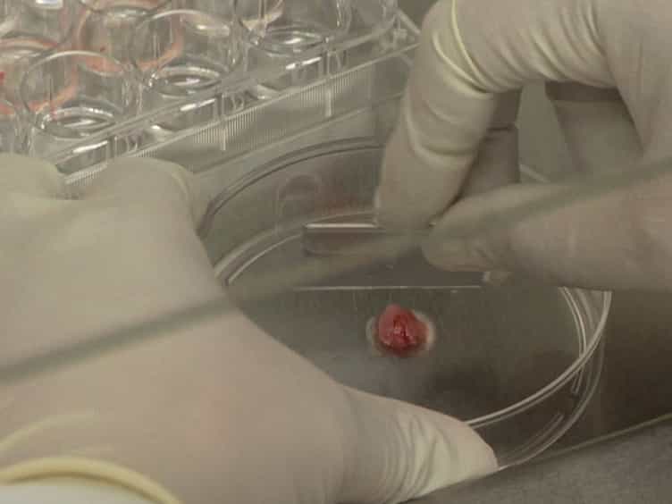Primary Tumor and MEF Cell Isolation to Study Lung Metastasis