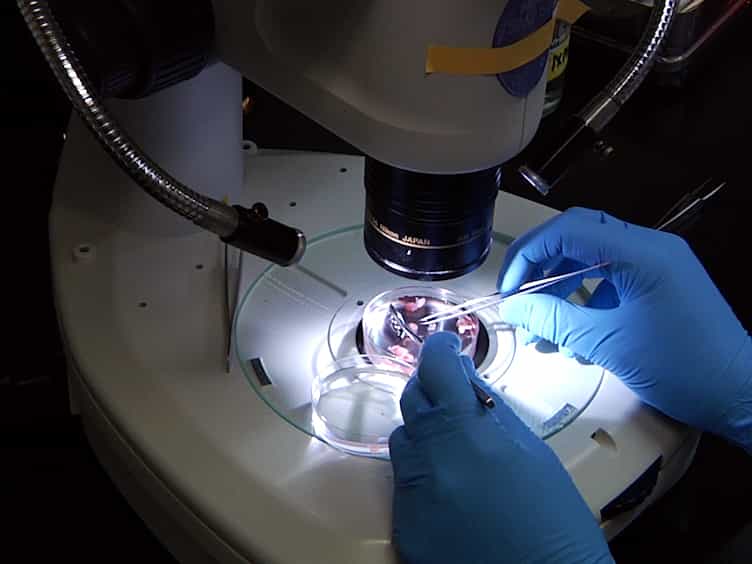 Immunostaining to Visualize Murine Enteric Nervous System Development
