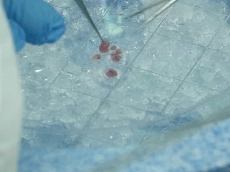 Isolation and Cryopreservation of Neonatal Rat Cardiomyocytes