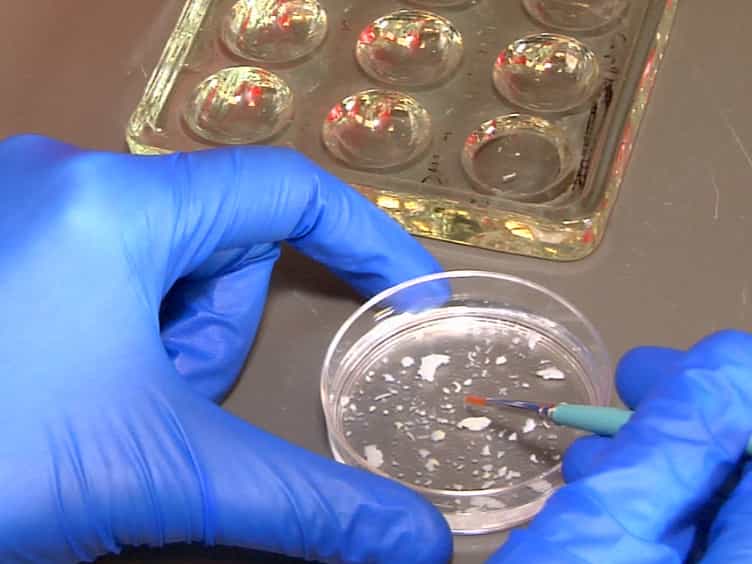 Assaying Blood Cell Populations of the Drosophila melanogaster Larva