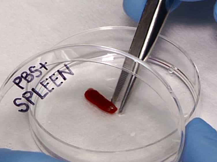Mouse Naïve CD4+ T Cell Isolation and In vitro Differentiation into T Cell Subsets