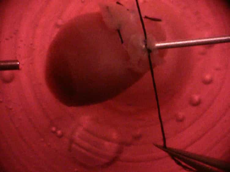 Culturing Mouse Cardiac Valves in the Miniature Tissue Culture System