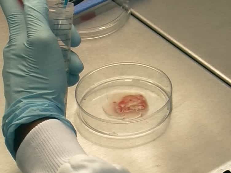 Studying Pancreatic Cancer Stem Cell Characteristics for Developing New Treatment Strategies