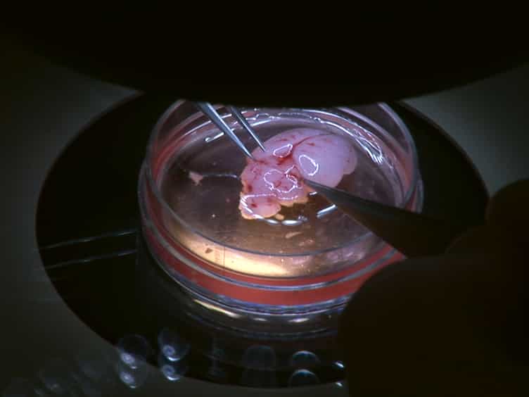 Ex Vivo Imaging of Postnatal Cerebellar Granule Cell Migration Using Confocal Macroscopy