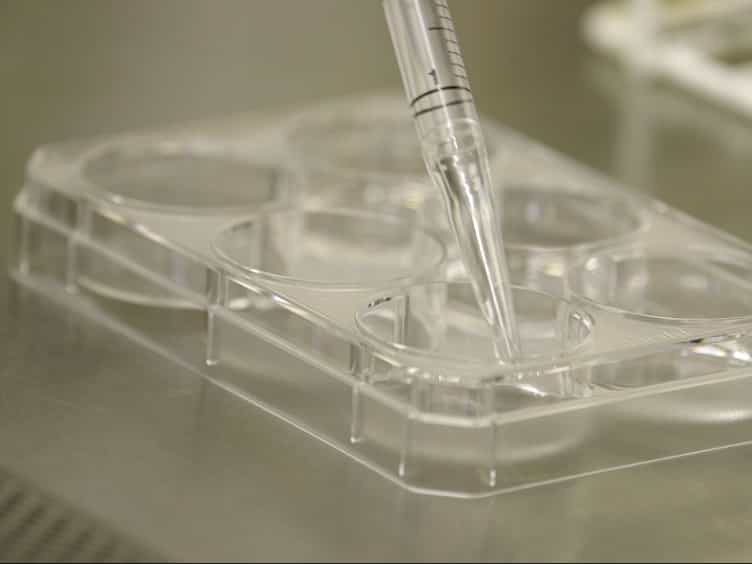 Neural Differentiation of Mouse Embryonic Stem Cells in Serum-free Monolayer Culture