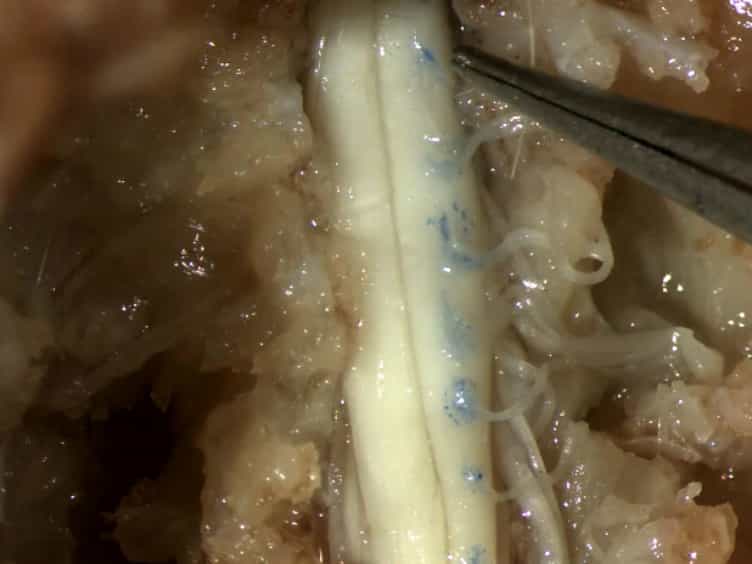 Intramuscular Injections Along the Motor End Plates: A Minimally Invasive Approach to Shuttle Tracers Directly into Motor Neurons