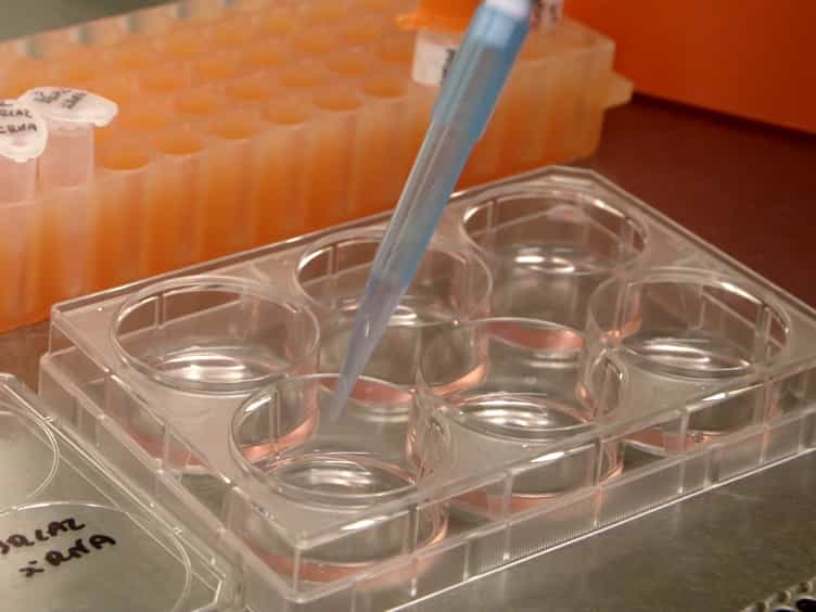 Silencing of BRCA2 to Identify Novel BRCA2-regulated Biological Functions in Cultured Human Cells
