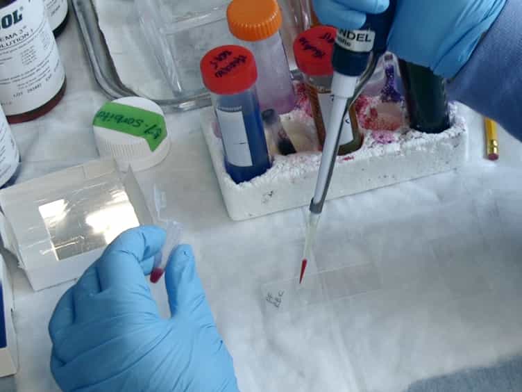 An In Vitro Model for Measuring Immune Responses to Malaria in the Context of HIV Co-infection