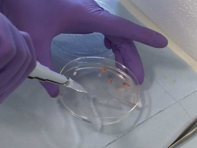 Selective Depletion of Microglia from Cerebellar Granule Cell Cultures Using L-leucine Methyl Ester