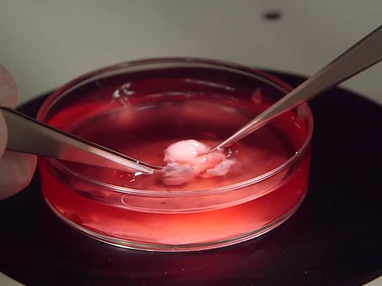 Observation of the Ciliary Movement of Choroid Plexus Epithelial Cells Ex Vivo