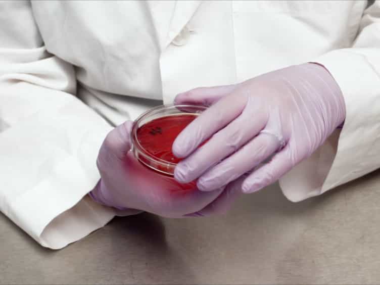 A Reference Broth Microdilution Method for Dalbavancin In Vitro Susceptibility Testing of Bacteria that Grow Aerobically