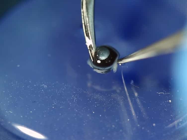 Limbal Approach-Subretinal Injection of Viral Vectors for Gene Therapy in Mice Retinal Pigment Epithelium