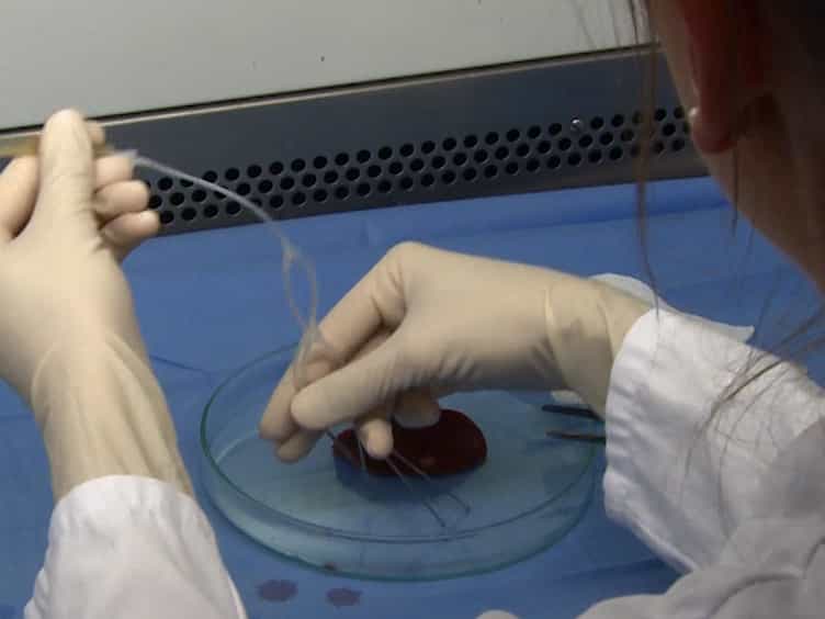 Protocol for Isolation of Primary Human Hepatocytes and Corresponding Major Populations of Non-parenchymal Liver Cells