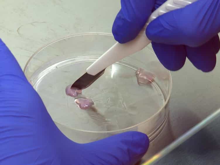 A 3D Human Lung Tissue Model for Functional Studies on Mycobacterium tuberculosis Infection