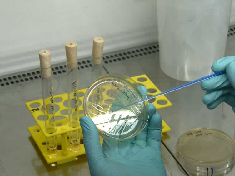 Analysis of Yersinia enterocolitica Effector Translocation into Host Cells Using Beta-lactamase Effector Fusions