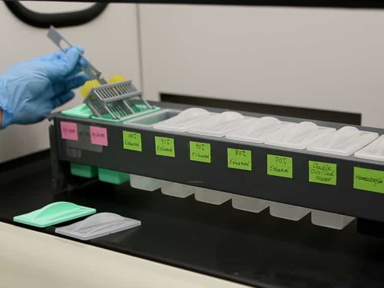 miRNA Expression Analyses in Prostate Cancer Clinical Tissues