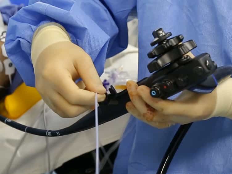 Intraoperative Gastroscopy for Tumor Localization in Laparoscopic Surgery for Gastric Adenocarcinoma