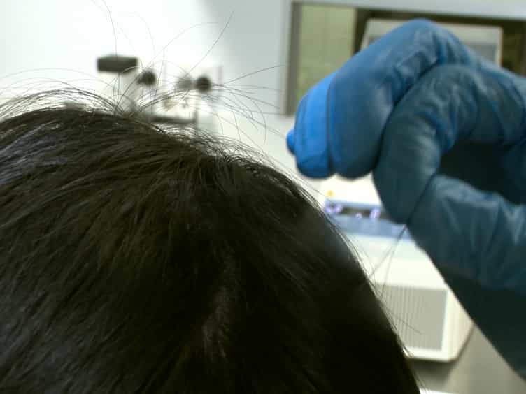 Generation of Integration-free Human Induced Pluripotent Stem Cells Using Hair-derived Keratinocytes