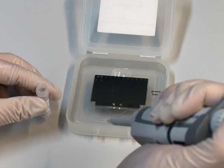 Identification of Rare Bacterial Pathogens by 16S rRNA Gene Sequencing and MALDI-TOF MS