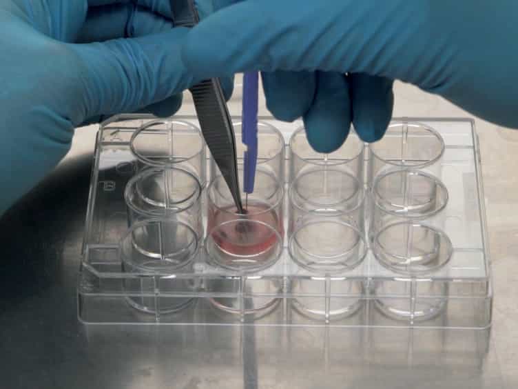 An Optimized Method for Isolating and Expanding Invariant Natural Killer T Cells from Mouse Spleen