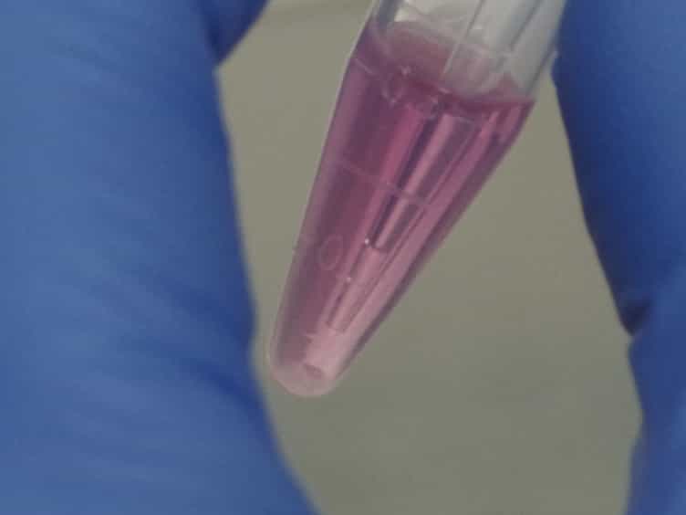 A Cancer Cell Spheroid Assay to Assess Invasion in a 3D Setting