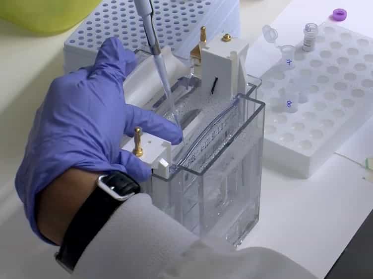 Sequential Extraction of Soluble and Insoluble Alpha-Synuclein from Parkinsonian Brains