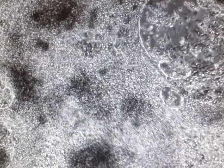 Construction of Defined Human Engineered Cardiac Tissues to Study Mechanisms of Cardiac Cell Therapy