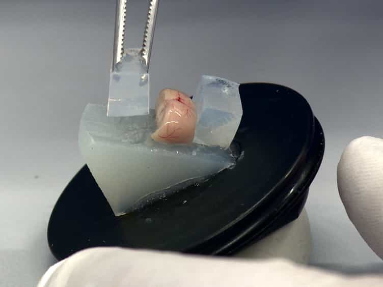 Ex Vivo Optogenetic Dissection of Fear Circuits in Brain Slices