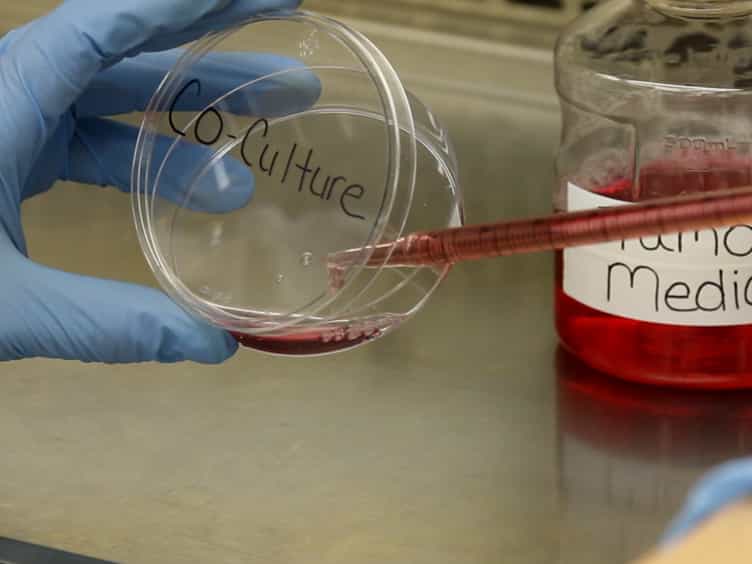 Modeling Chemotherapy Resistant Leukemia In Vitro