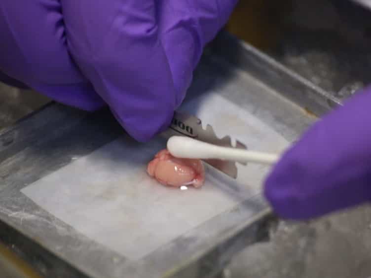 Direct-current Stimulation and Multi-electrode Array Recording of Seizure-like Activity in Mice Brain Slice Preparation