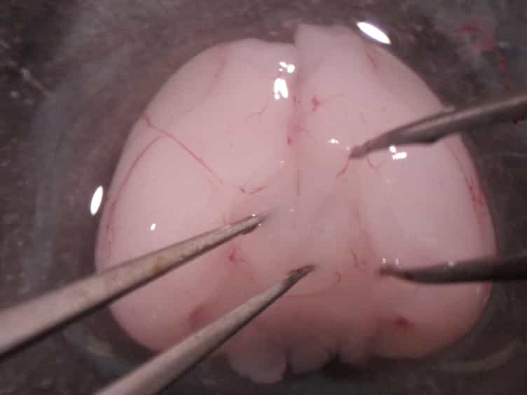 Preparation of Rat Oligodendrocyte Progenitor Cultures and Quantification of Oligodendrogenesis Using Dual-infrared Fluorescence Scanning