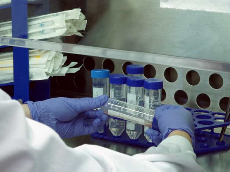 Isolation of CD146+ Resident Lung Mesenchymal Stromal Cells from Rat Lungs