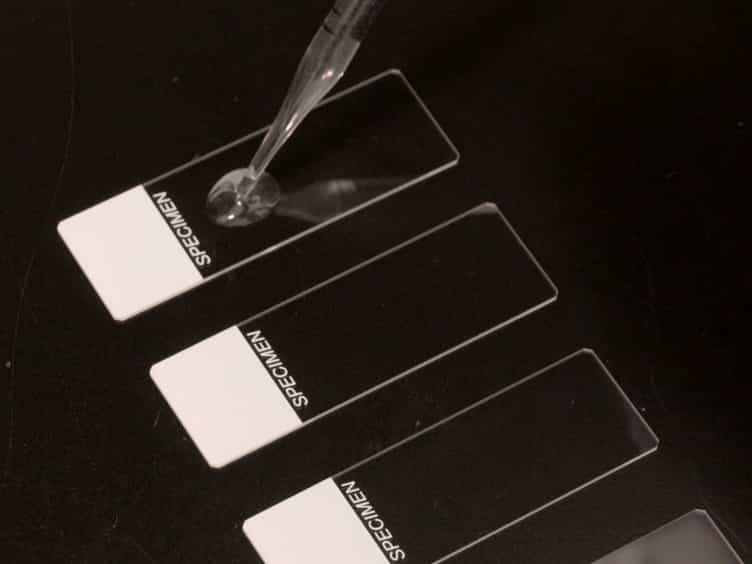 Qualitative and Quantitative Assays for Detection and Characterization of Protein Antimicrobials