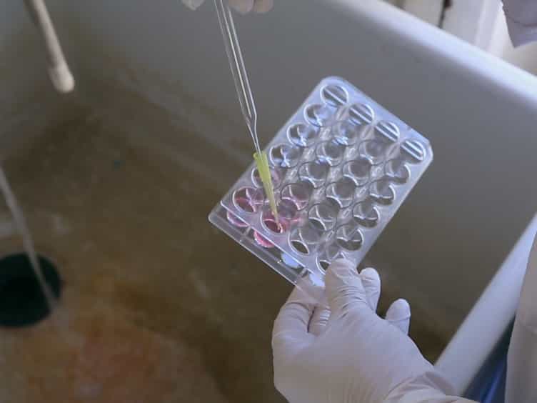 Neutrophil Isolation and Analysis to Determine their Role in Lymphoma Cell Sensitivity to Therapeutic Agents