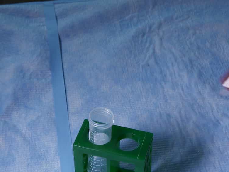 Selective Harvesting of Marginating-pulmonary Leukocytes