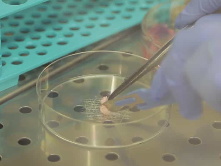 Establishment of Cancer Stem Cell Cultures from Human Conventional Osteosarcoma