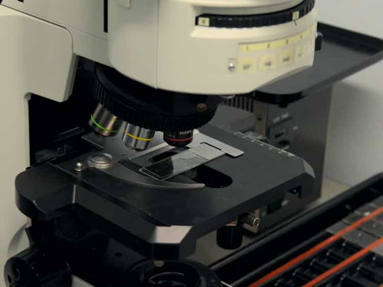 Clinicopathological Analysis of miRNA Expression in Breast Cancer Tissues by Using miRNA In Situ Hybridization