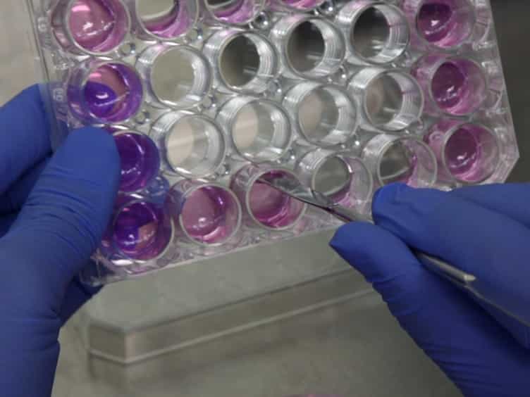 Development of an In Vitro Assay to Evaluate Contractile Function of Mesenchymal Cells that Underwent Epithelial-Mesenchymal Transition