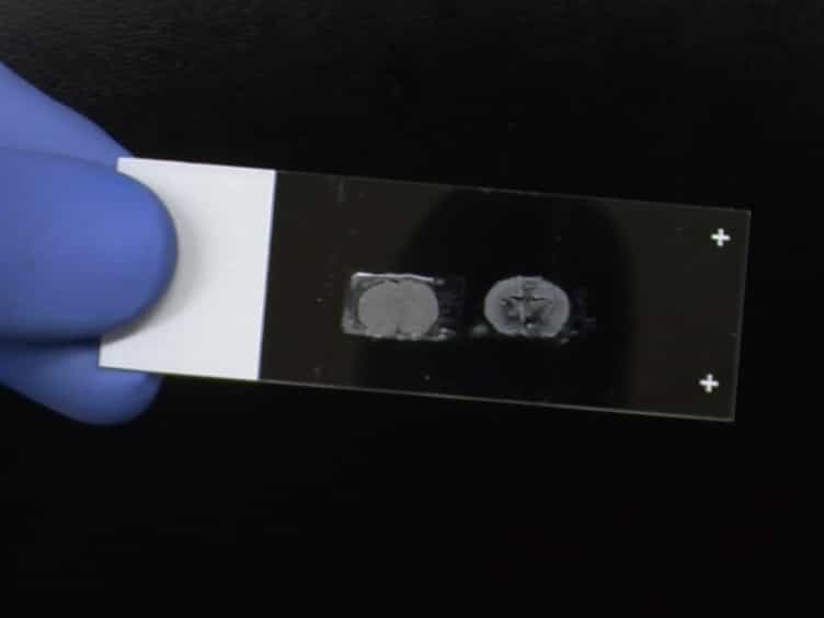 Combining Double Fluorescence In Situ Hybridization with Immunolabelling for Detection of the Expression of Three Genes in Mouse Brain Sections