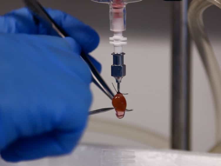 Isolation of Murine Coronary Vascular Smooth Muscle Cells