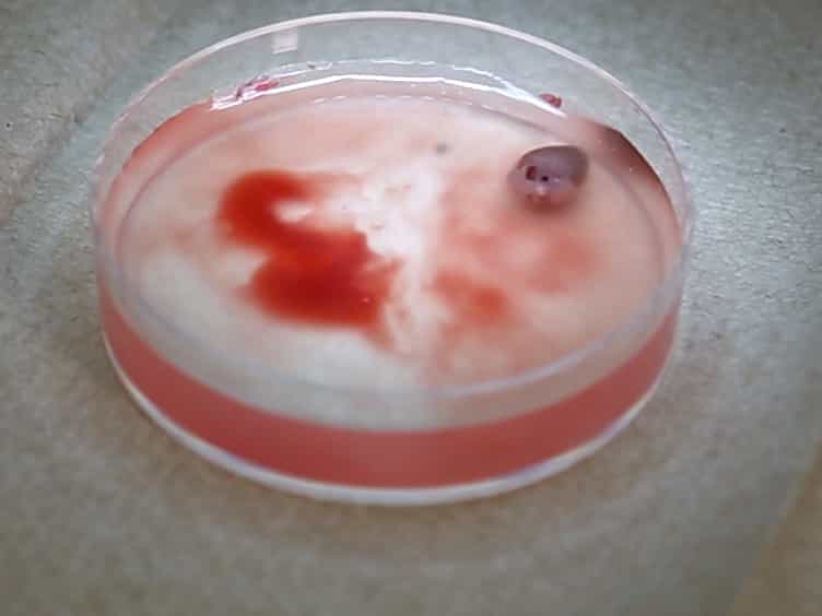 Isolation of Mouse Coronary Endothelial Cells
