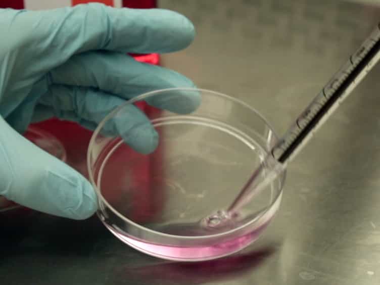Injection of Syngeneic Murine Melanoma Cells to Determine Their Metastatic Potential in the Lungs
