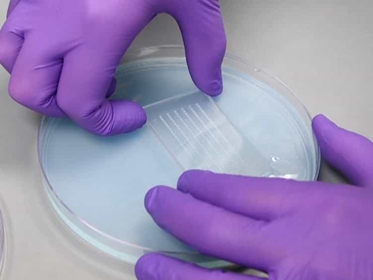 Nephrotoxin Microinjection in Zebrafish to Model Acute Kidney Injury