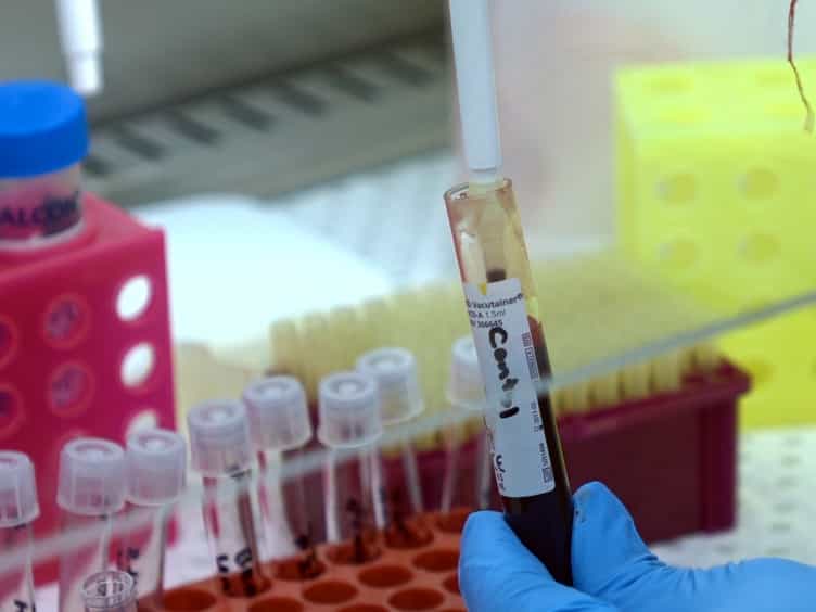 A Simple Flow Cytometric Method to Measure Glucose Uptake and Glucose Transporter Expression for Monocyte Subpopulations in Whole Blood