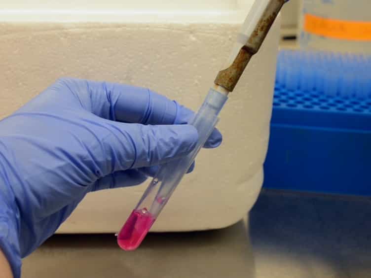 Three-Dimensional Culture Assay to Explore Cancer Cell Invasiveness and Satellite Tumor Formation