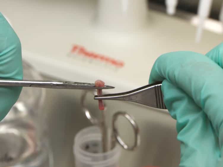 Competitive Transplants to Evaluate Hematopoietic Stem Cell Fitness