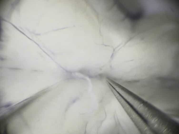 Protocol for Isolating the Mouse Circle of Willis
