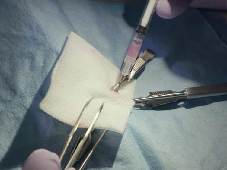 Murine Experimental Model of Original Tumor Development and Peritoneal Metastasis via Orthotopic Inoculation with Ovarian Carcinoma Cells