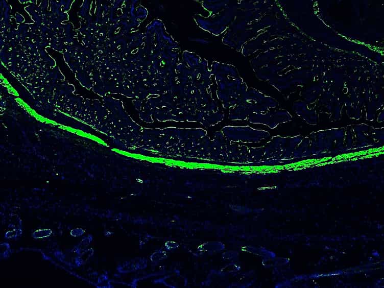 Creation of Abdominal Adhesions in Mice